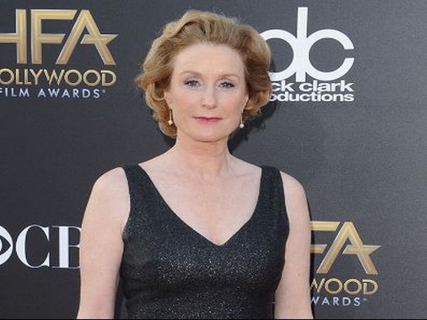 ‘Gone Girl’ actor Lisa Banes critical after hit-and-run scooter accident